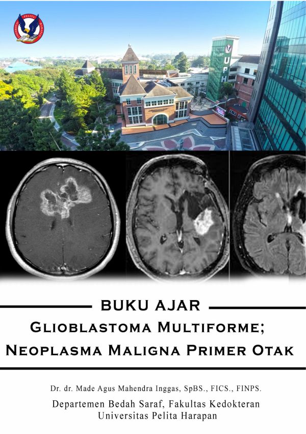Buku Ajar Glioblastoma Multiforme; Neoplasma Maglina Primer Otak